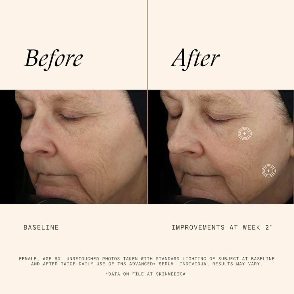 Image from Amazon.com https://amzn.to/3ZXAxvn