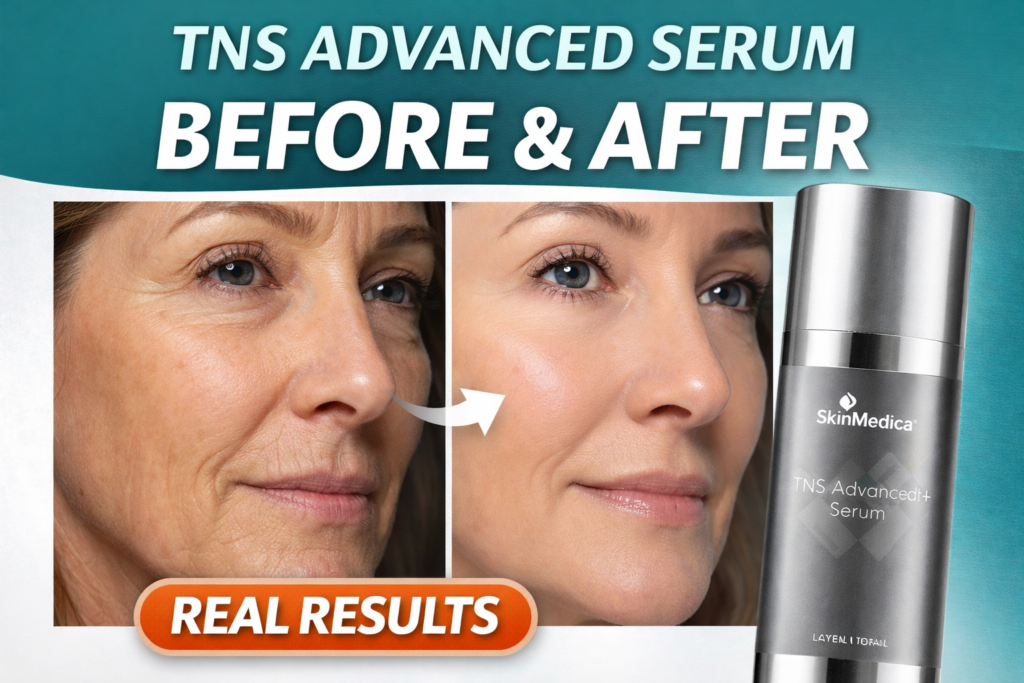 SkinMedica TNS Advanced+ Serum
