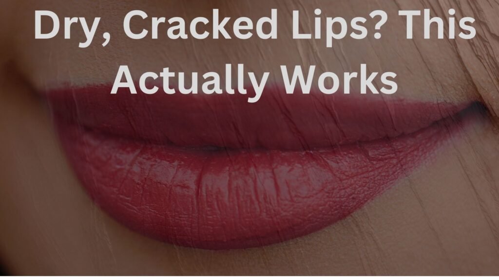 dry, cracked lips this actually works