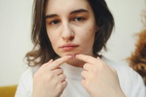 Adult Female Acne? 7 Treatments That Actually Work (Clear Hormonal Breakouts Fast)
